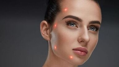 Kaj je delno pomlajevanje kože