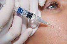Postopek biorevitalizacije